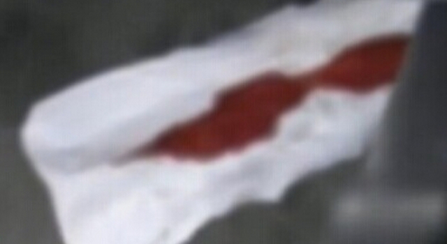 血淋淋的教训:女子吵架 一人抽正使用姨妈巾甩对方脸上