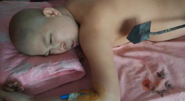 年轻妈妈无钱手术欲用烙铁烫死癌细胞 同情者与质疑者均存在