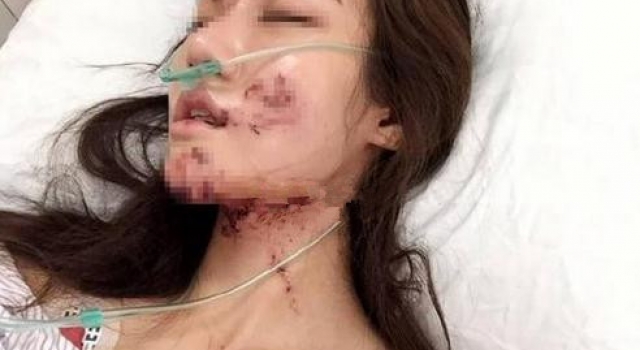 网红坐宝马遇车祸毁容 男子竟找替死鬼欲私了