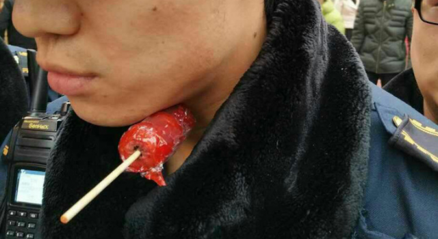 惊心!重庆城管执法被老太刺喉 糖葫芦竹签直戳脖子上