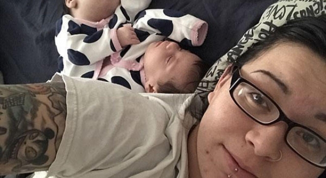母爱的力量 女子坚持诞下连体双胞胎孩子十分健康