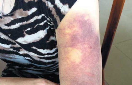 ���ӱ�������3Ů��  1ǰ��2�������������󶾴�