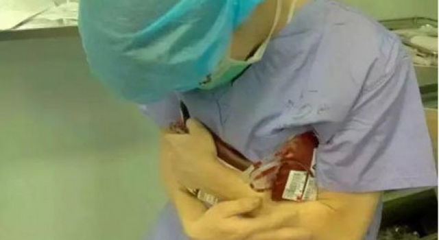 手术台上急需用血 医生怀捂4度血袋:求快点升温 救命呢