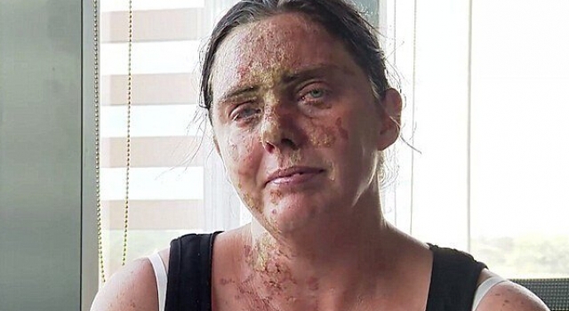 丧心病狂!英国俩兄弟向母亲泼硫酸 弟弟逃走击掌庆祝