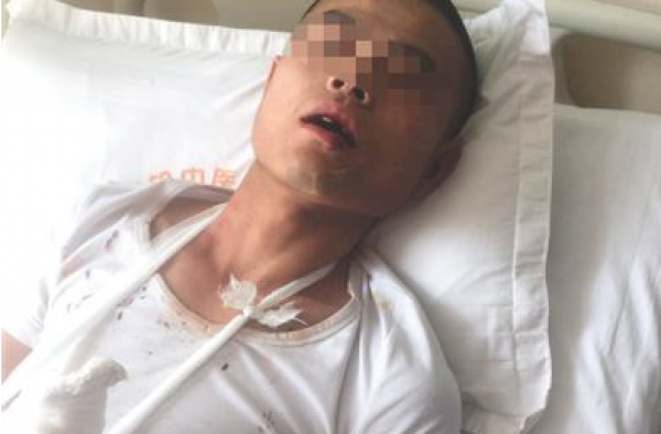 沙子被垄断？男子送沙被砍断手筋 "沙霸"：再送弄死你