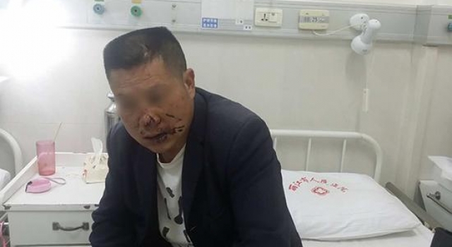 丽江古城"城管"酒后伤人 回应：打人者为合同工