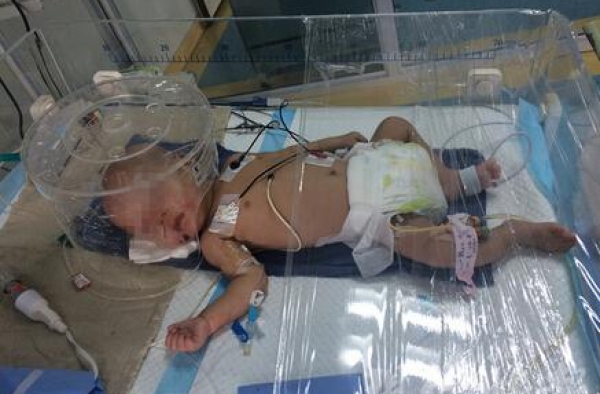男婴肋骨骨折头颅出血疑遭虐待 父亲笑称摔过两三回
