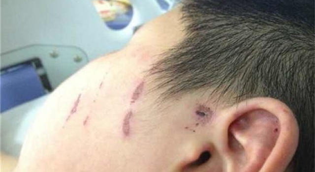 惊！14岁男孩拐9岁男童至宾馆：板凳砸头 烟头烫身
