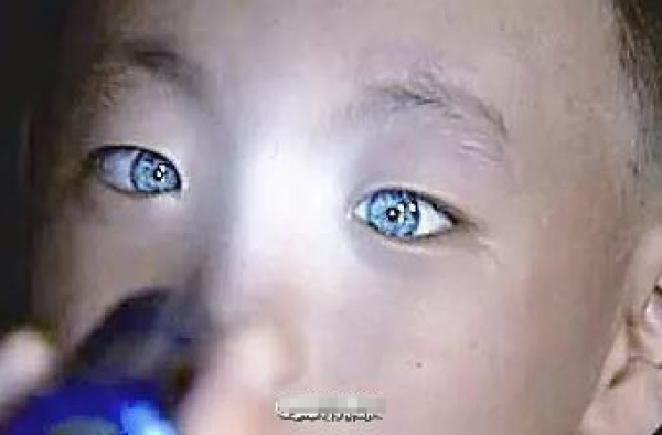 男童天生蓝色＂猫眼＂自带夜视功能 黑暗中能清晰写字
