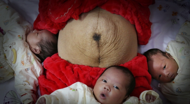 最牛妈妈肚皮像干瘪柚子皮 生下双胞胎9年后迎来三胞胎