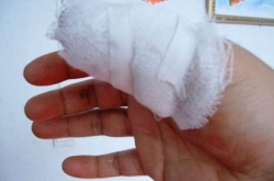 �Ϻ���ȭ����Ĵָ������ȴҪ����ָ