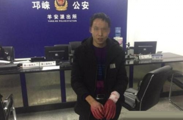 为挽回女友用红墨水假装割腕自杀 网友：戏精非你莫属