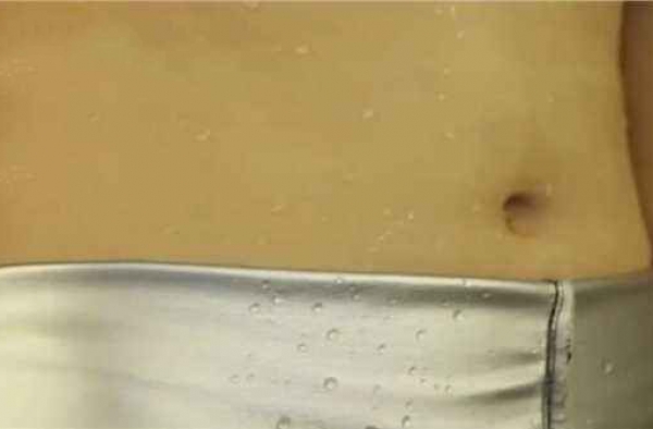 网红暴汗服真的那么有效？ 医生提醒减肥需谨慎