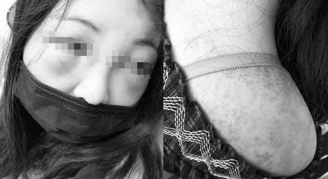 女生打呼噜遭群殴 警方现已立案调查