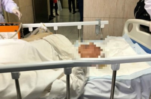 医学名人李谋秋在路上被外卖小哥撞倒，最后导致死亡