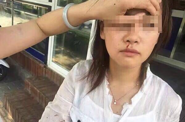 滴滴司机打伤乘客 究竟谁对谁错