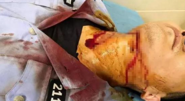 制服嫌犯被割喉发生了什么?竟然敢袭警?犯了什么罪?