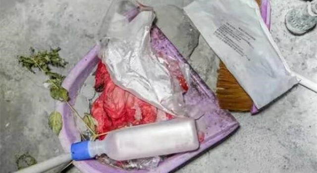 泼酸割喉重伤妻儿   妻儿重伤男子家暴后上吊身亡