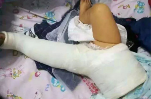 婴儿被狗撞伤残怎么回事？撞成十级伤残还跑路？