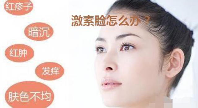 激素脸应该怎么治疗 分析激素脸多久能恢复正常