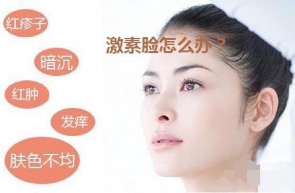 激素脸怎么解决？轻度激素脸有什么症状