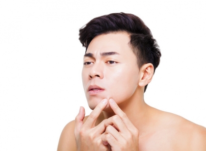 男生护肤祛痘 褪去满脸痘的光环谁还敢说你不帅？