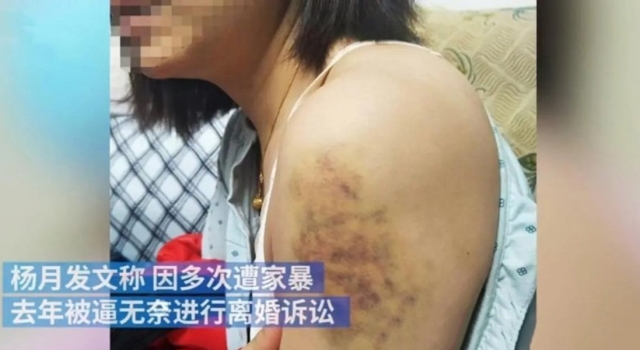 妻子公开曝光被丈夫家暴16年 网友：希望多判几年