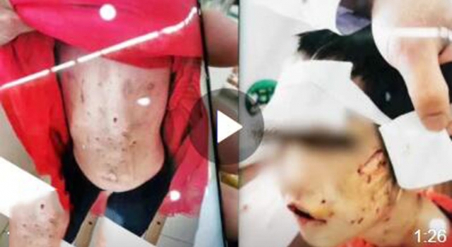 黑龙江虐打4岁女童父亲继母被批捕 网友：判重点吧