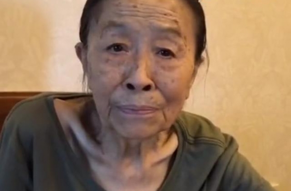 83岁＂丑娘＂张少华瘦成皮包骨，说话气短无力，健康状况堪忧