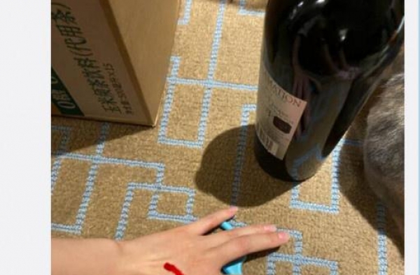 林允受伤出血小号连发照片 网友：拍照比止血重要