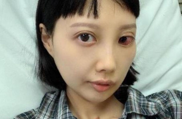 香港歌手李明蔚癌症恶化，她说她想活下去，我眼眶湿了