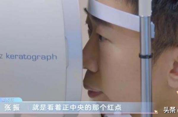 杨迪睑板腺消失，三十岁的人五十岁的眼睛，电子产品是罪魁祸首