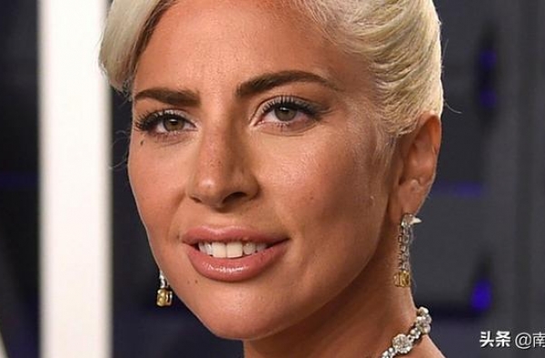 Lady Gaga：“所有美国人都喝下了白人至上的毒药！”