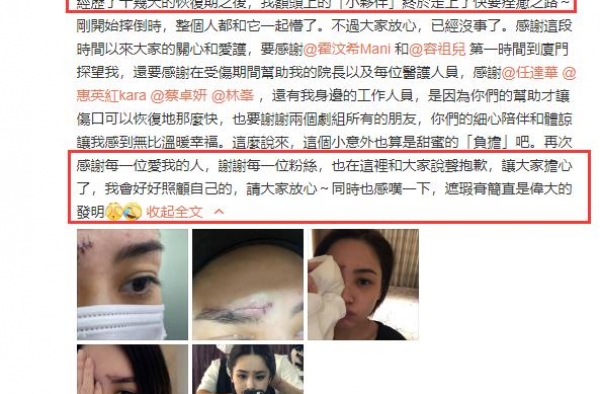 阿娇额头被撞后首晒高清伤口照，皮肤布满针孔看后令人头皮发麻