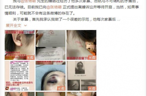 张培萌方回应家暴控诉 否认婚外关系：无中生有