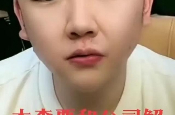 2亿解约费木森与老板闹掰，大美拿6000万，二嫂借1700万