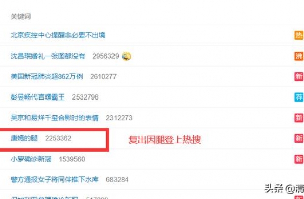 唐嫣出席活动，因腿冲上热搜