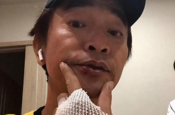 吴宗宪骑车四肢摔伤，要做脑部检查